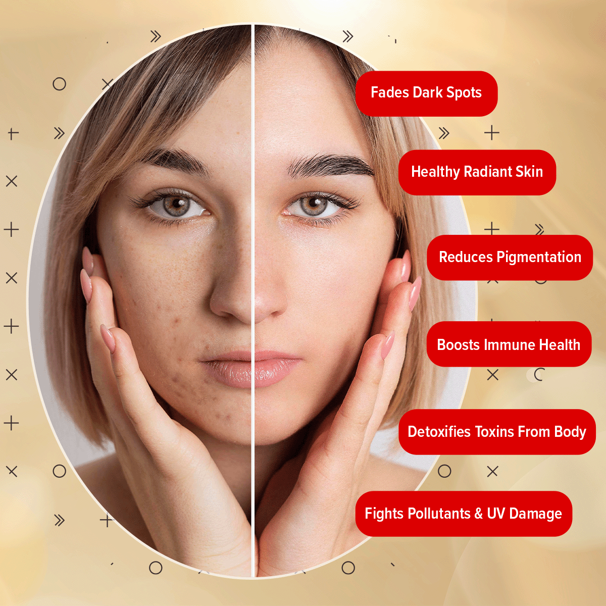 glutathione and skin pigmentation This One Tablet Can Helps to Treat Common Skin Issues Like Dark spots,  Pigmentation, Uneven skin tone & Dryness , ✨Product : @hkvitals Glutathione  Tablets , • there are so many Glutathione tablets